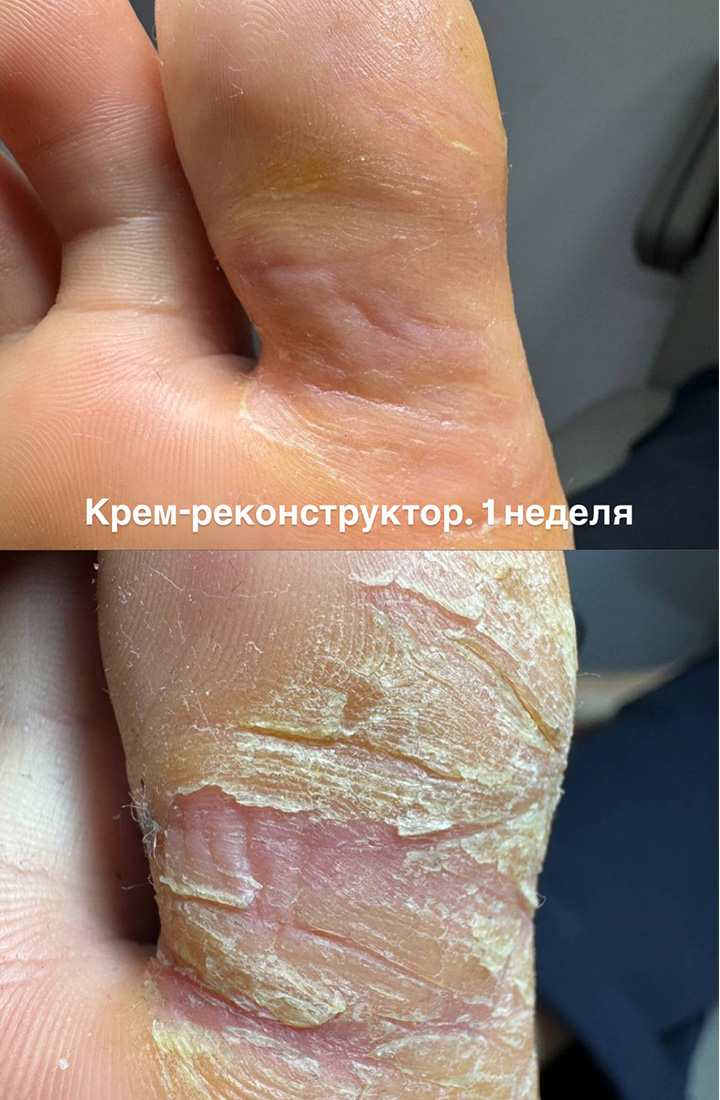 отзыв 10 крем реконструктор Podiafarm