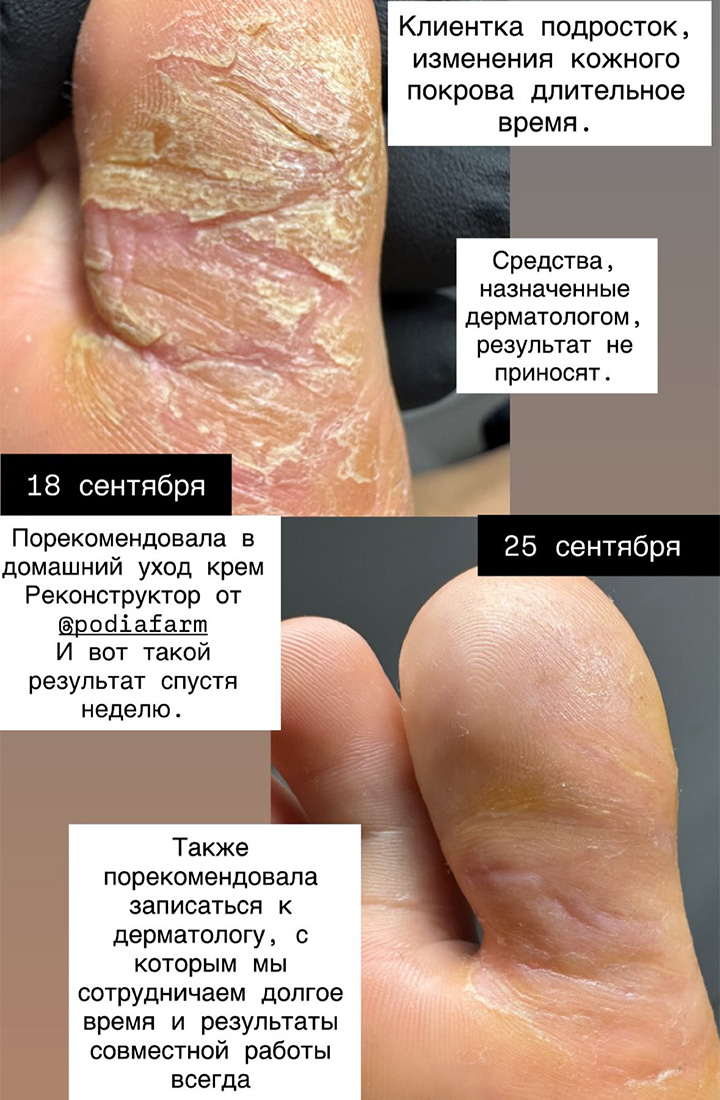 отзыв 11 крем реконструктор Podiafarm