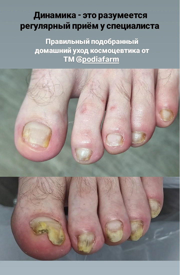 отзыв 13 крем реконструктор Podiafarm
