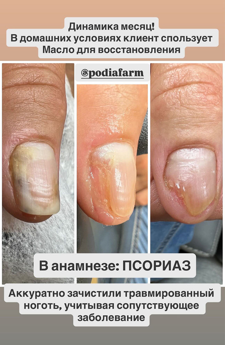 отзыв 16 масло для восстановления Podiafarm