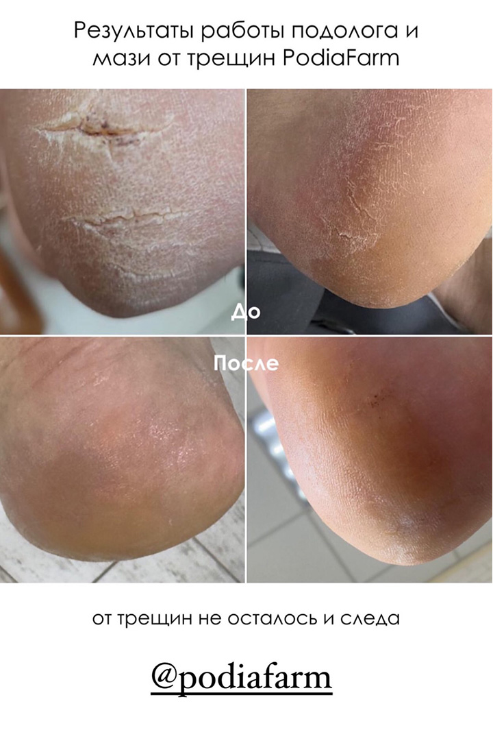 отзыв 17 мазь от треин Podiafarm
