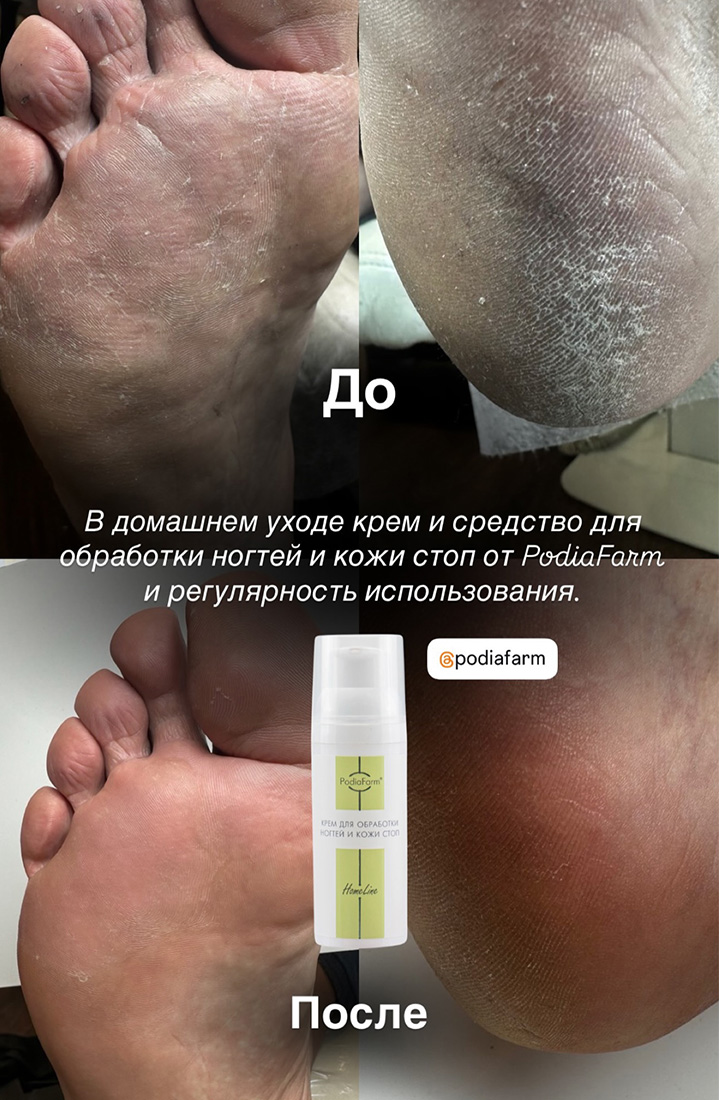 отзыв 18 крем и средство для обработки ногтей и кожи стоп Podiafarm