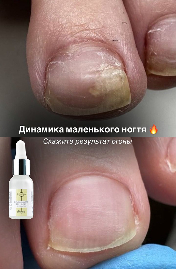 отзыв 19 бальзам масло для ногтей Podiafarm