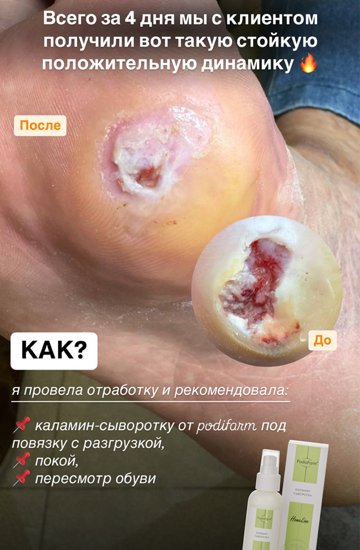 отзыв 20 каламин-сыворотка Podiafarm