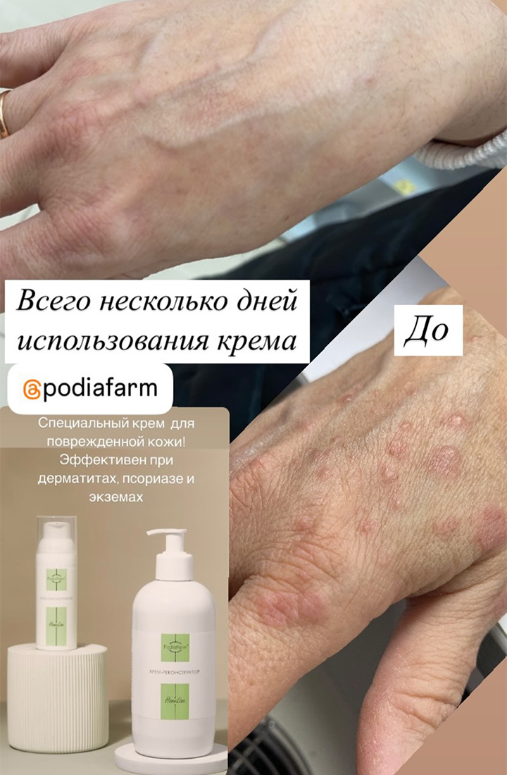 отзыв 21 крем реконструктор Podiafarm