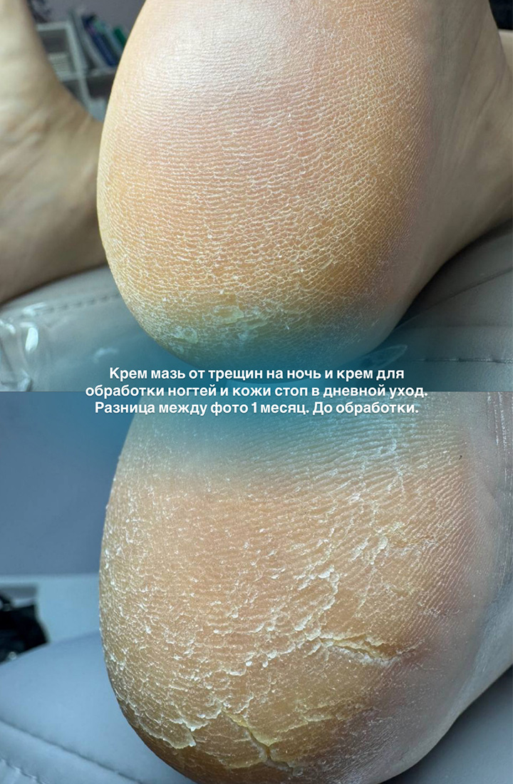 отзыв 9 крем мазь от трещин Podiafarm
